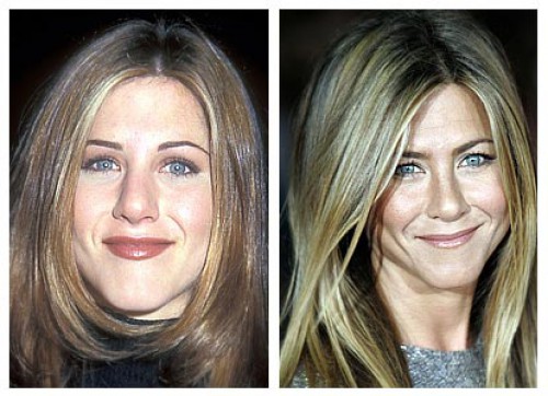 Jennifer-Aniston-Plastic-Surgery-Before-And-After-Nose-Job-Rhinoplasty-Kiev-Ukraine