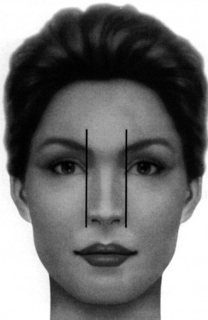 aesthetic facial analysis for rhinoplasty 4