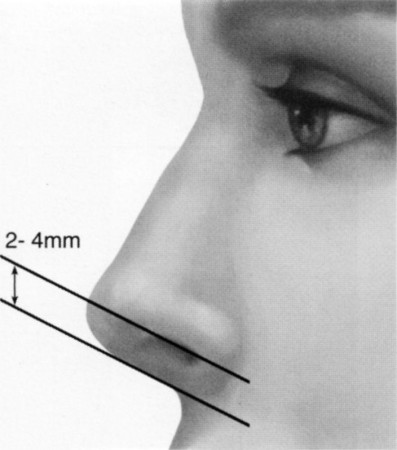 aesthetic facial analysis for rhinoplasty 13
